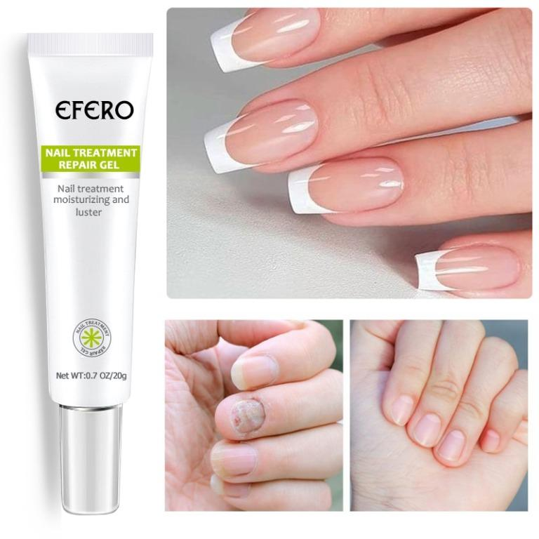 Efero MyCare™ Gel pentru tratamentul unghiilor