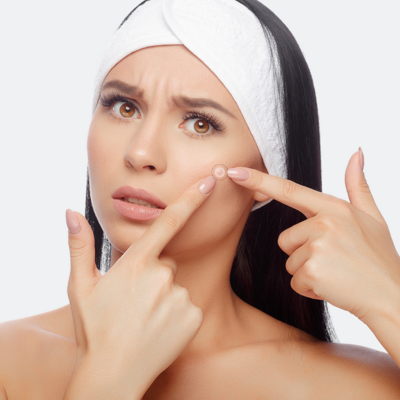 DermaReliv Pro+™️ Plasturi pentru îndepărtarea petelor de pe piele