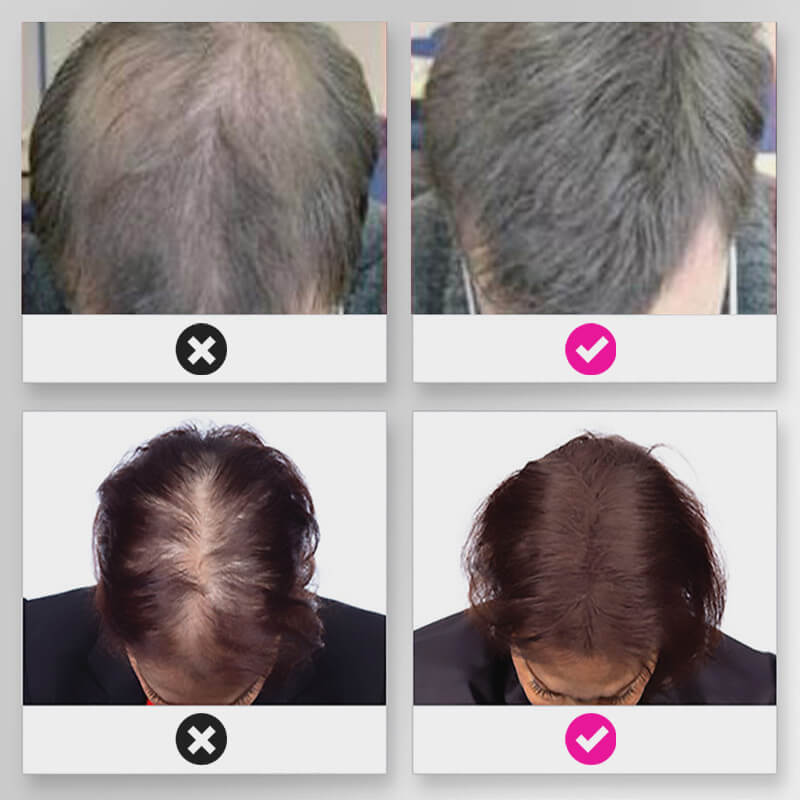 EELHOE HAIR™ Pudră împotriva căderii părului și umplerea rapidă a firului de păr